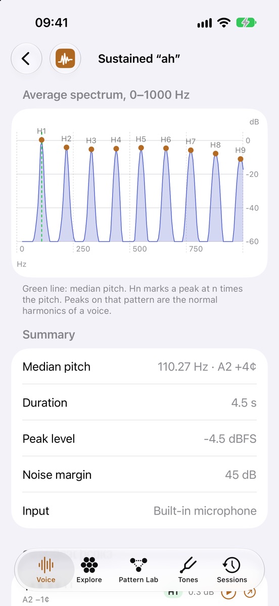 MindTimbre voice print of a sustained “ah” at 110 Hz (A2): the average spectrum shows nine evenly spaced peaks labelled H1 to H9, with a summary of median pitch, duration, peak level and noise margin underneath.